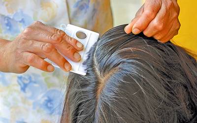 5 Things To Do Immediately About lice